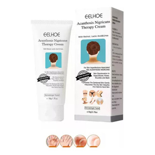 Crema Fixderma Nigrify Para La Acantosis Nigricans Fbg*1pc Crema Fixderma Nigrify Para La Acantosis Nigricans Fbg*1pc