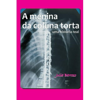 Libro: A Menina Da Coluna Torta: Uma História Real Edition) Libro: A Menina Da Coluna Torta: Uma História Real Edition)