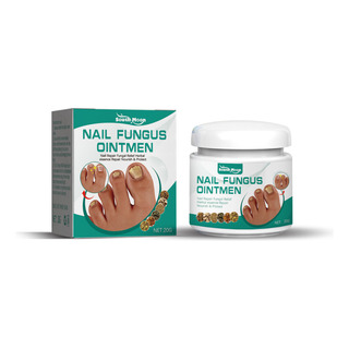 Pomada Para Peeling De Unhas De Onicomicose (20g) Pomada Para Peeling De Unhas De Onicomicose (20g)