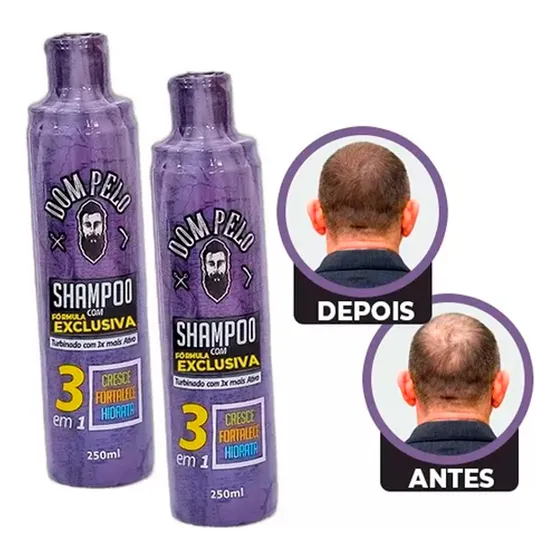  2 Shampoo Nixidil Fortificante 3 Em 1 - Dom Pelo 250ml