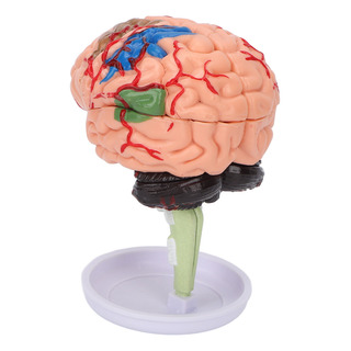 Modelo De Enseñanza Humano Desmontado Ensamblaje Cerebral Modelo De Enseñanza Humano Desmontado Ensamblaje Cerebral