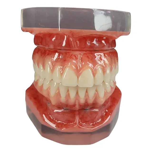 Macro Modelo E  Protocolo Superior De Implantes