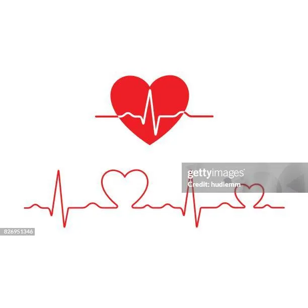 Estudios Cardiologicos 