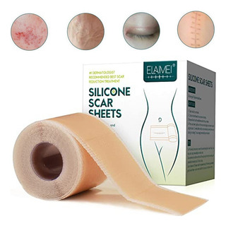 - Parches De Silicona Reutilizables Para Cicatrices De - Parches De Silicona Reutilizables Para Cicatrices De