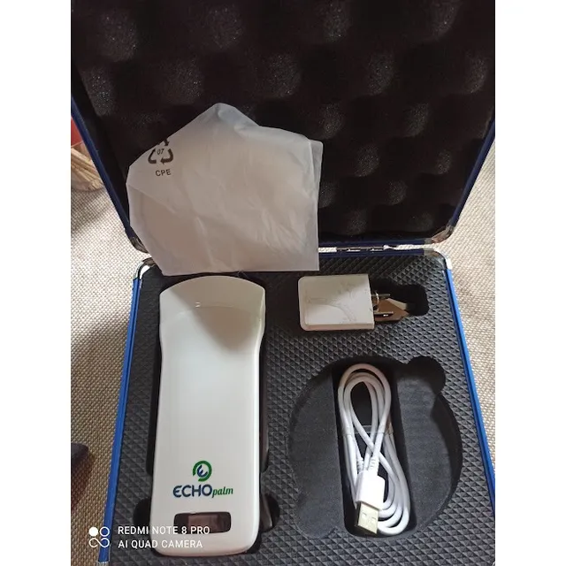 Ecógrafo Ultraportátil Inalámbrico Transductor Convex 3.5-5