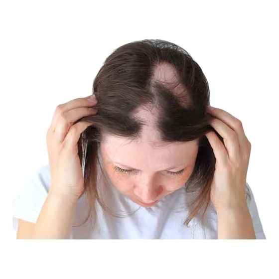 Barba Roja Para Cabello Abundante Tonico