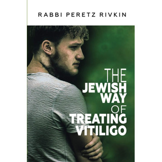 Livro: Em Inglês, A Maneira Judaica De Tratar O Vitiligo Livro: Em Inglês, A Maneira Judaica De Tratar O Vitiligo