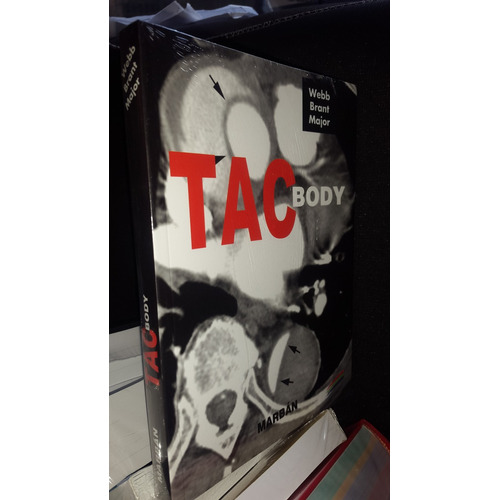 Tac Body - Webb - Formato Residente - Marban