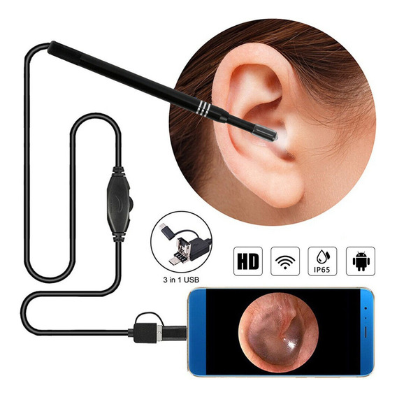 Otoscopio Digital, Cámara De Oídos Para Usar En Pc Y Celular