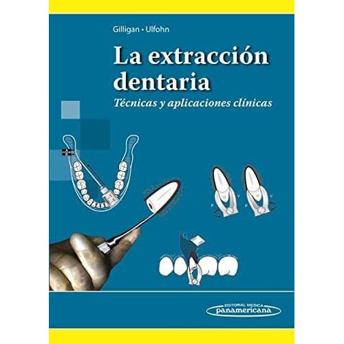 La Extraccion Dentaria: Tecnicas Y Aplicaciones Clinicas
