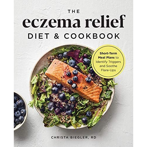 The Eczema Relief Diet & Cookbook : Short-term Meal Plans To Identify Triggers And Soothe Flare-ups, De Rd  Christa Biegler. Editorial Rockridge Press, Tapa Blanda En Inglés