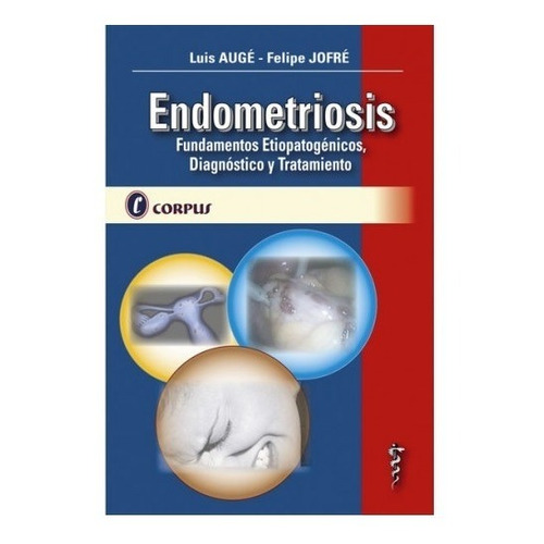 Auge Endometriosis Corpus