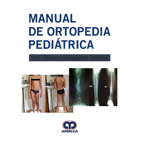 Manual De Ortopedia Pediátrica Campagnaro