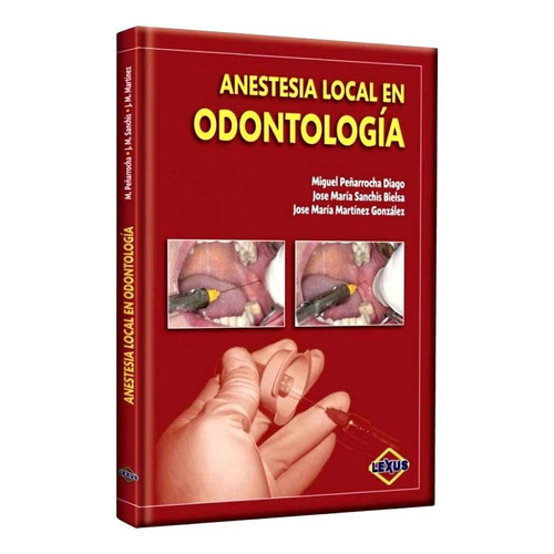 Libro Anestesia Local En Odontología