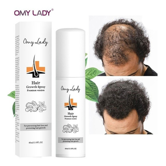 Omy Lady Spray Tratamiento Calvicie Caída Cabello 60 Ml