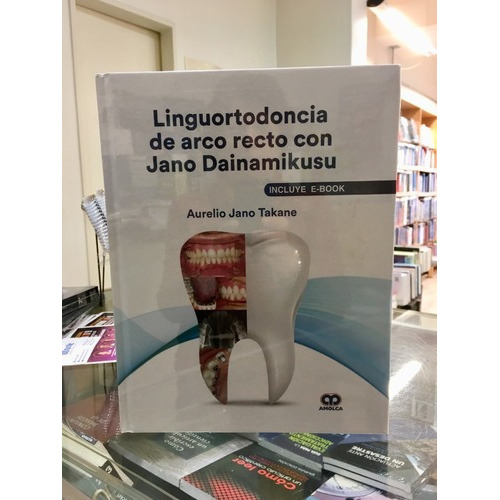 Libro Linguortodoncia De Arco Recto Con Jano Dainami, De Aurelio Jano Takane. Editorial Amolca En Español
