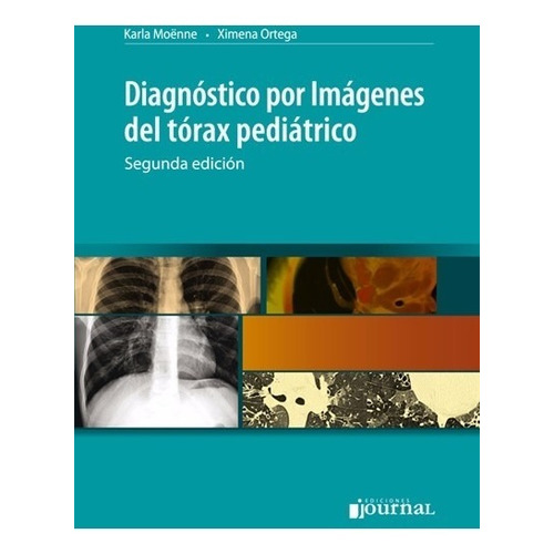 Diagnostico Por Imagenes Del Torax Pediatrico -  Journal