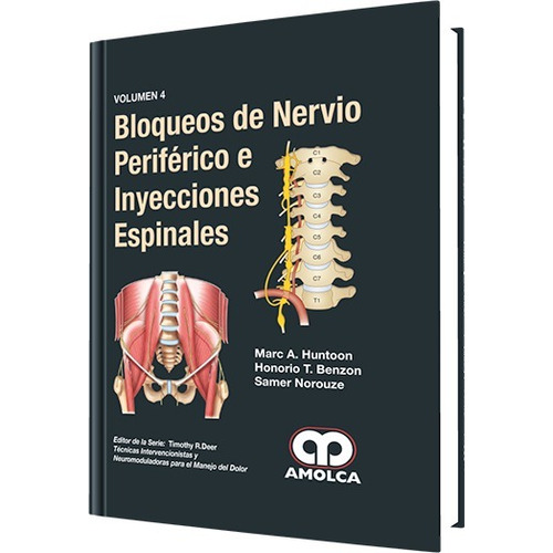 Bloqueos De Nervio Periférico E Inyecciones Espinal Vol 4