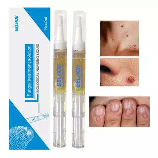 2 Und Verrugas Papiloma Lunares Herpes Genital Rostro Cuerpo