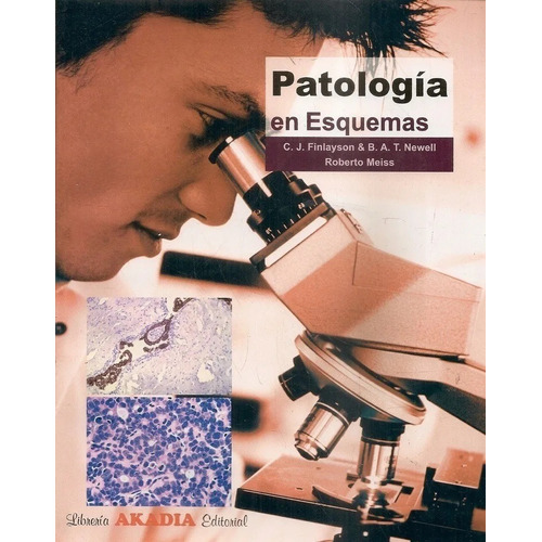 Patología En Esquemas Finlayson !