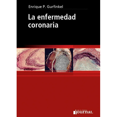 La Enfermedad Coronaria, De Gurfinkel., Vol. No Aplica. Editorial Journal, Tapa Blanda En Español, 2008