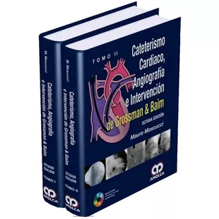 Cateterismo Cardiaco Angiografía E Intervención De Grossman