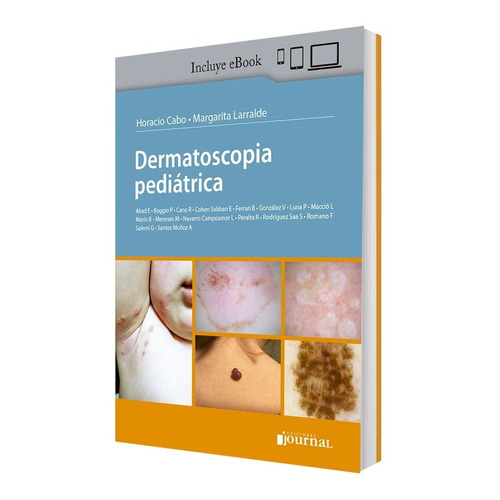 Dermatoscopia Pediatrica