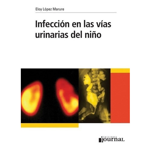 Infección en las vías urinarias del niño, de López Marure, Eloy. Editorial EDICIONES JOURNAL, tapa blanda, edición 1 en español, 2012
