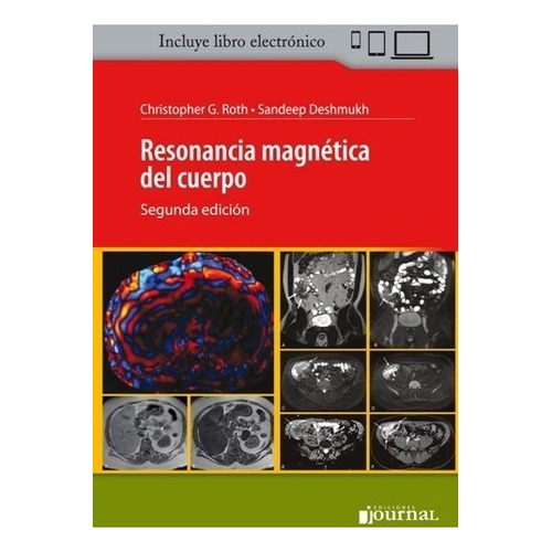 Roth Resonancia Magnética Del Cuerpo 2º/2018 Nue Env T/país