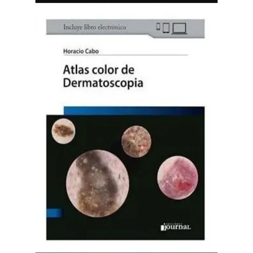 Atlas Color De Dermatoscopia Incluye Libro Electronico
