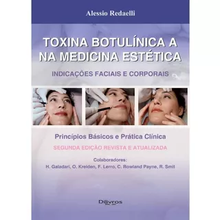 Toxina Botulinica A Na Medicina Estetica - Indicações Faciai
