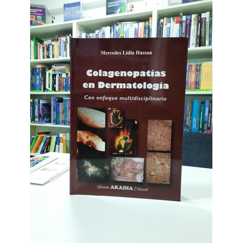 Hassan Colagenopatías En Dermatología Todo País