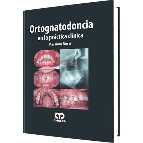 Ortognatodoncia En La Práctica Clínica.
