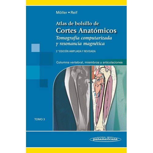 Atlas De Cortes Anatómicos.tomo 3. 2ª Ed. - Torsten B. Molle