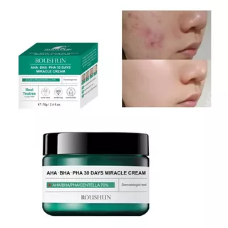 Aha Bha Pha Crema Antiacne 30dias Centella Asiática 70% Tipo De Piel Grasa