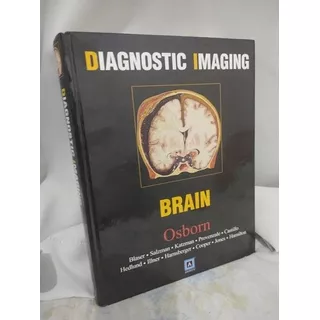 Diagnostic Imaging Brain Capa Dura Em Inglês Osborn Blaser