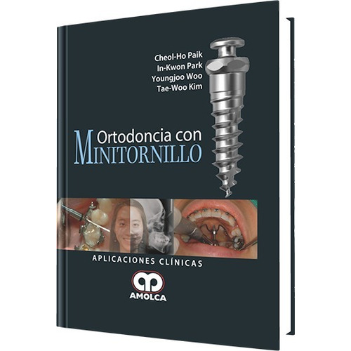Ortodoncia Con Minitornillo Paik