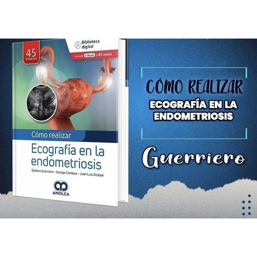 Como Realizar Ecografía En La Endometriosis +e-book, De Stefano Guerreiro Y Otros., Vol. 1. Editorial Amolca, Tapa Dura, Edición 1 En Español, 2022