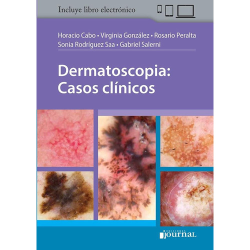 Dermatoscopia Casos Clinicos