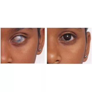 Lente De Contacto Pupila Negra Pupilente  Cosmetico 