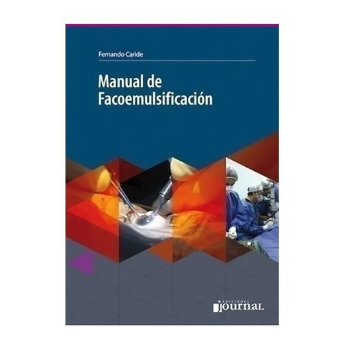 Manual De Facoemulsificación Caride !