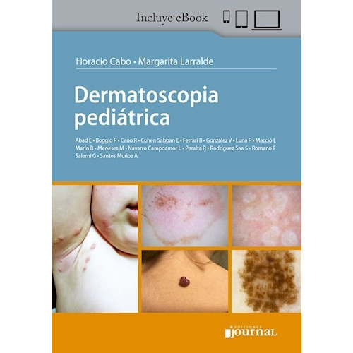 Dermatoscopia Pediátrica Journal
