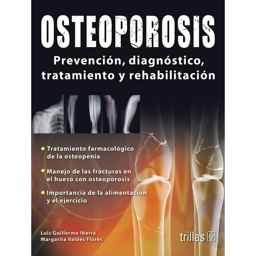 Osteoporosis Prevención Diagnóstico Tratamiento Trillas