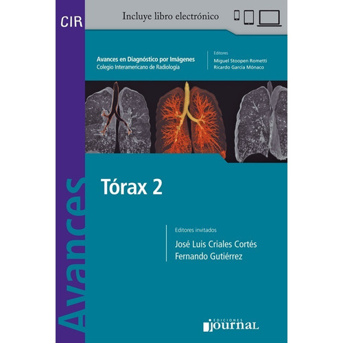 Torax 2 Avances En Diagnostico Por Imagen