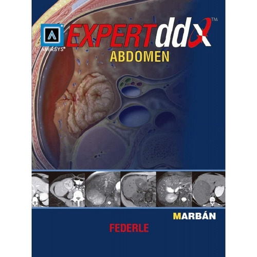 Expert Ddx Abdomen