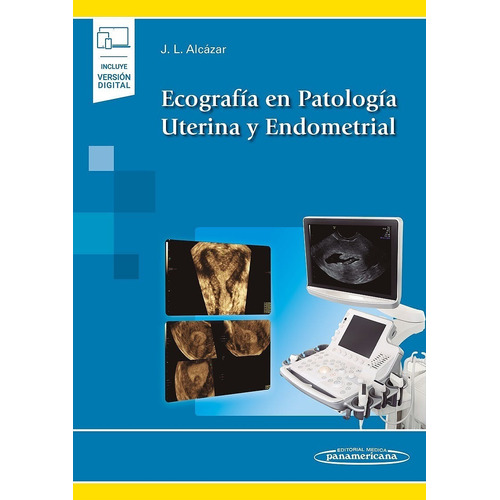 Ecografía En Patología Uterina Y Endometrial Autor: Alcazar
