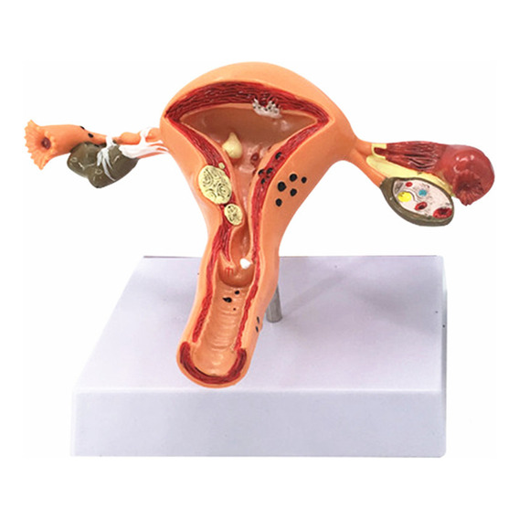 Modelo De Útero, Órgano Reproductor Femenino