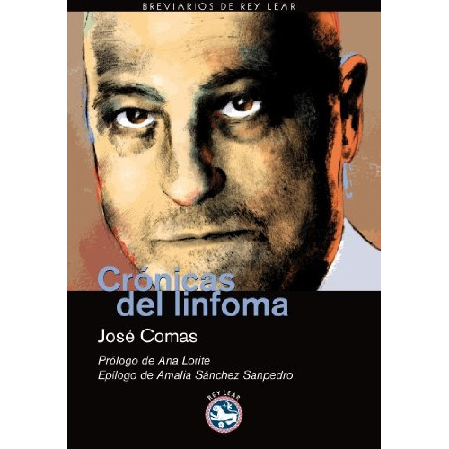 Cronicas Del Linfoma, De Jose  Comas. Editorial Rey Lear, Edición 1 En Español