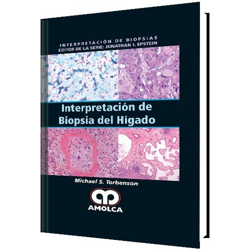 Interpretación De Biopsia Del Hígado