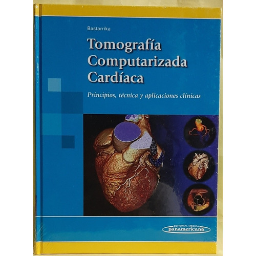 Tomografía Computarizada Cardiaca